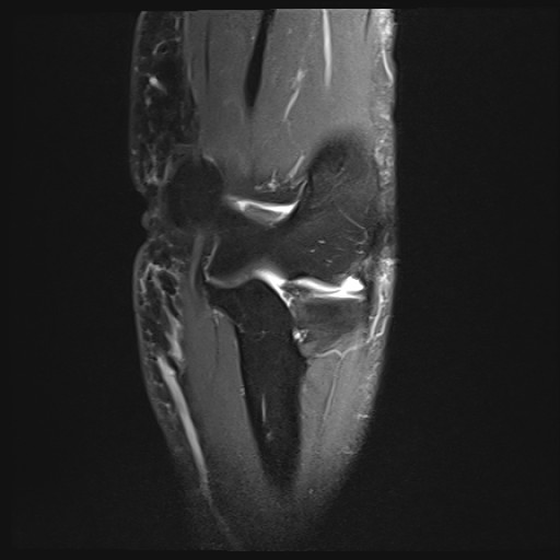 Click on the Serie image to view the images of Wieszt, Gnter